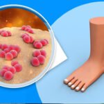 Ausbruch der Maul- und Klauenseuche in Deutschland