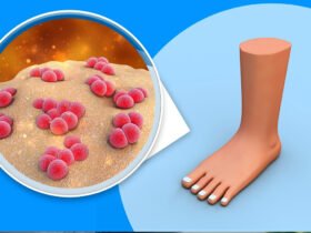 Ausbruch der Maul- und Klauenseuche in Deutschland