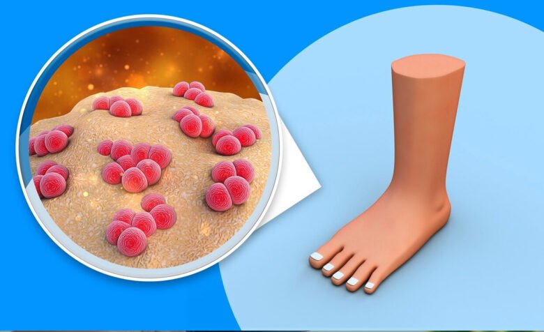 Ausbruch der Maul- und Klauenseuche in Deutschland